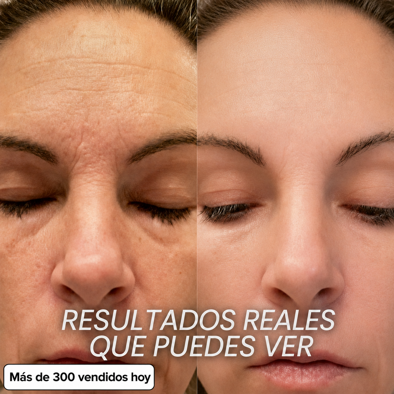 STICK RELLENADOR BIO-COLÁGENO PDRN