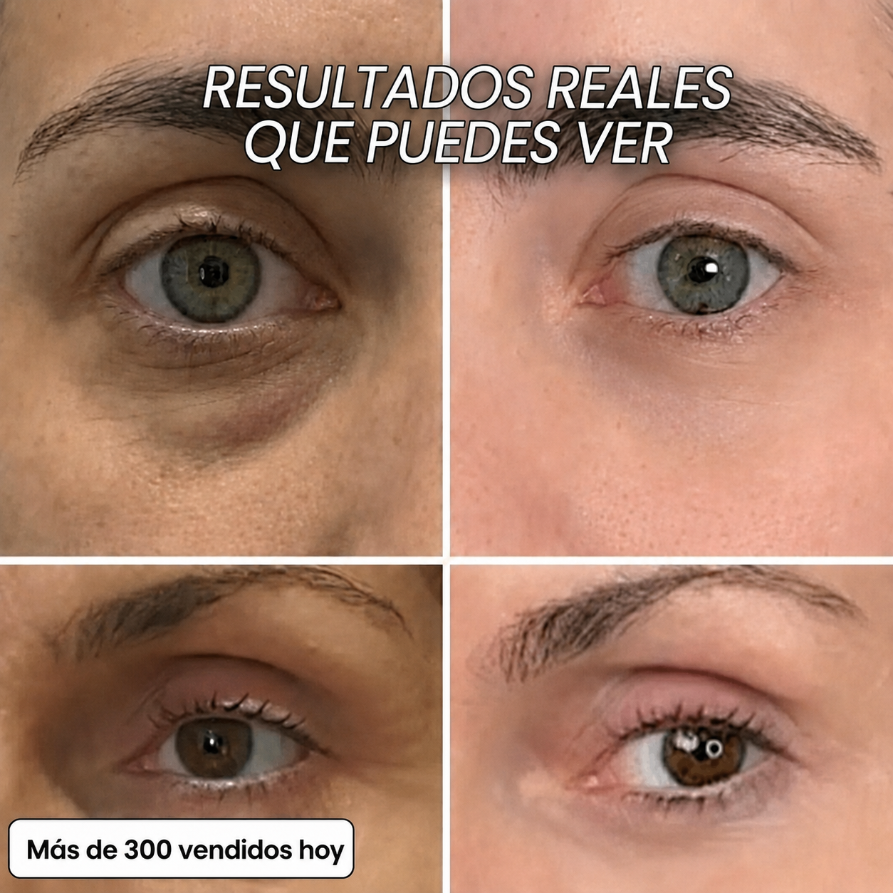 STICK RELLENADOR BIO-COLÁGENO PDRN
