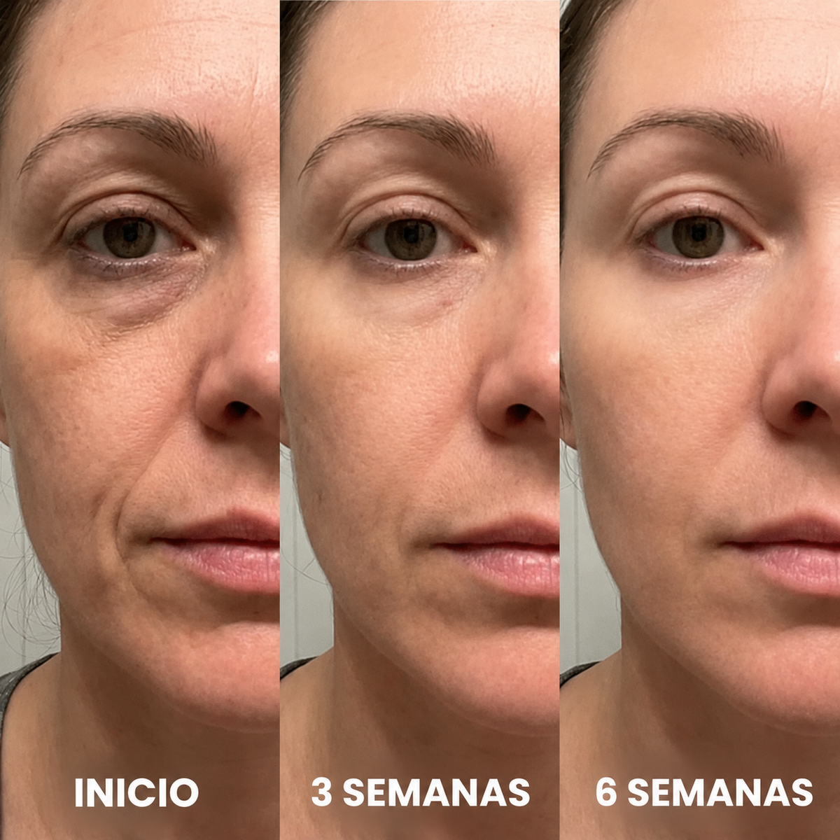 Resultados visibles antes y después
